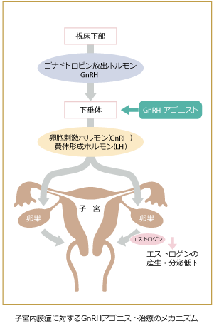 薬物療法